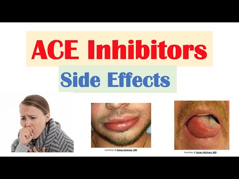 Ramipril Oral: Benefits, Risks, Interactions, and Images