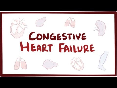 Understanding Heart Failure: A Comprehensive Visual Guide