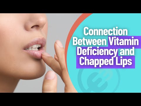 Understanding Vitamin Deficiencies and Chapped Lips post thumbnail image