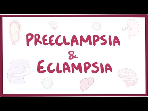 Essential Insights on Preeclampsia and Eclampsia Basics