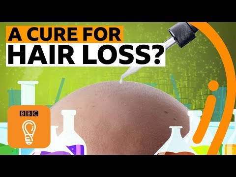 Could We Prevent Balding? New Insights from Recent Research