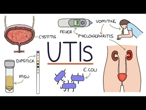 Understanding Kidney Infections and UTIs: Key Symptoms & Causes