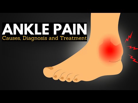 Understanding Sudden Ankle Pain: Causes and Solutions
