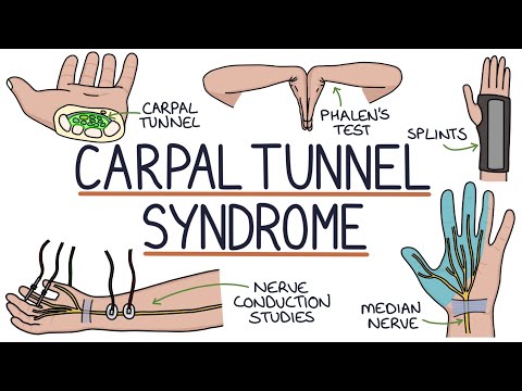 Understanding Carpal Tunnel Syndrome: Symptoms and Care post thumbnail image