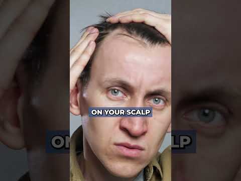 Understanding Minoxidil-Finasteride Side Effects and Risks
