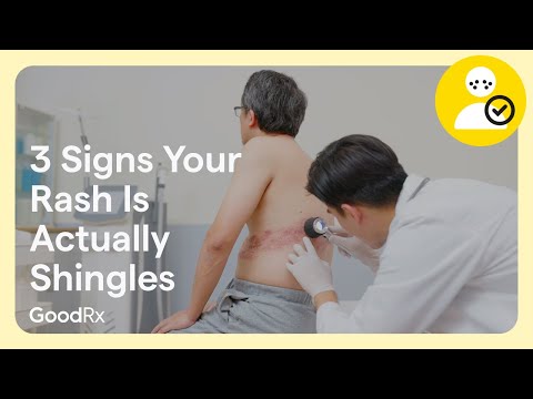 Shingles Rash: Visual Examples and What to Expect