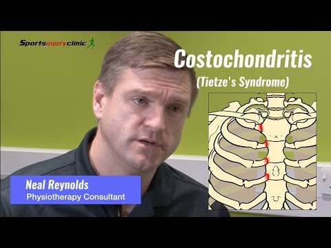 Understanding Costochondritis: Symptoms and Pain Points