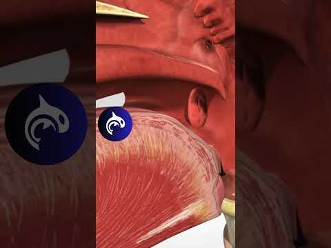 Understanding Persistent Sore Throat Without Fever or Cough