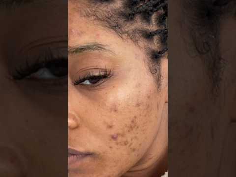 Tomato Benefits: Enhance Your Facial Skin Care Routine