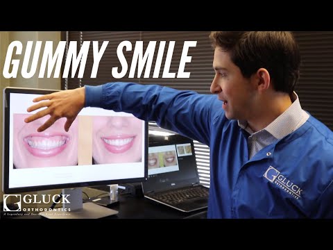 Understanding Gummy Smile Surgery and Your Treatment Options