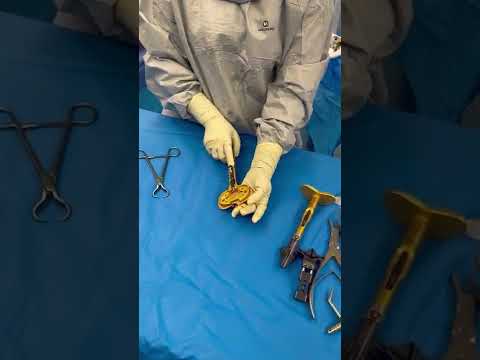 Arthroplasty: Insights on Uses, Effects, and Outcomes