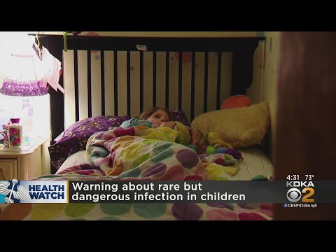Stay Alert: CDC's Warning on Rhinovirus and Enterovirus D-68