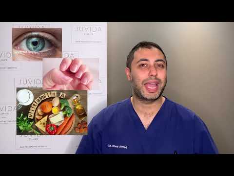 Does Masturbation Really Lead to Hair Loss? Find Out Now post thumbnail image
