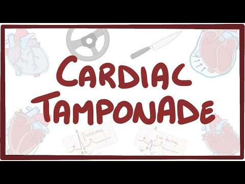 Understanding Cardiac Tamponade: Causes, Symptoms, and Care