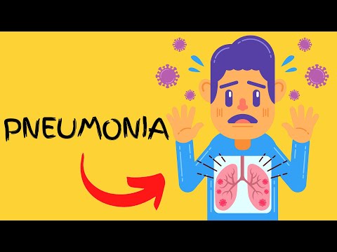 Understanding Bacterial Pneumonia: Symptoms and Solutions