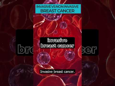 Invasive Ductal Carcinoma: What You Should Understand