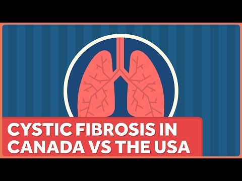 Understanding Cystic Fibrosis: Insights on Life Expectancy