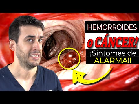 Picazón anal: Causas, síntomas y cómo identificarlo