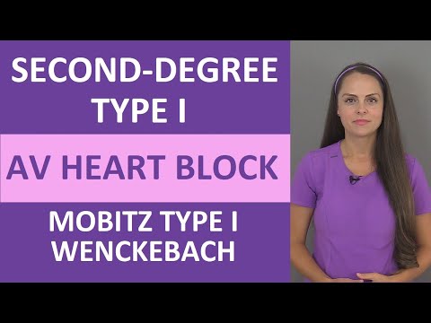 Understanding Second-Degree Heart Block: Symptoms and Causes