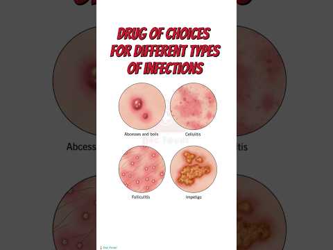 Understanding Conditions Treated by Oral Oxytetracycline