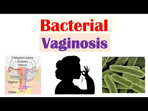 Effective Medications for Gardnerella Vaginalis BV Relief