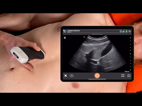 What to Expect During Your Gallbladder Ultrasound Appointment