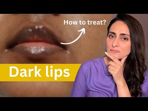 Essential Tips for Pink and Healthy Lips: Care and Treatments post thumbnail image