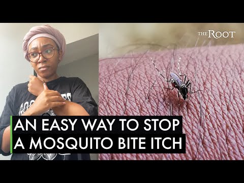 Top 9 Products for Fast and Effective Bug Bite Relief post thumbnail image