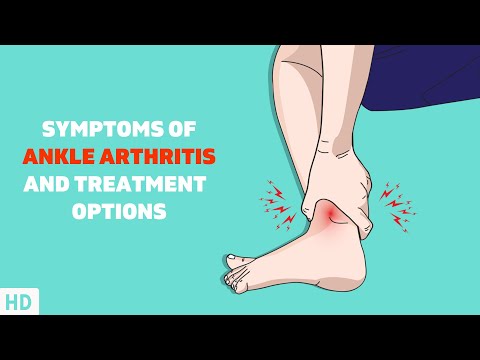 Understanding Ankle Pain When Walking: Conditions and Care