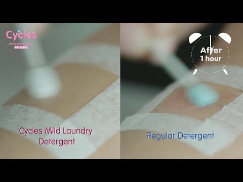 Choosing Baby Laundry Detergents for Healthier Skin Care post thumbnail image