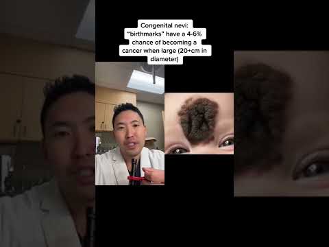 Nevus Sebaceous: Insights on Removal, Cancer Risk, and Care post thumbnail image