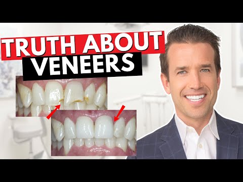 Understanding Small Teeth: Causes, Risks, and Treatment Options post thumbnail image