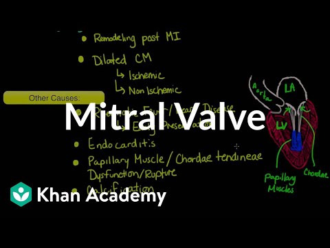 Understanding Mitral Valve Regurgitation: Signs and Causes