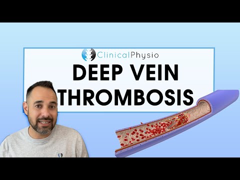 Recognizing Deep Vein Thrombosis: Symptoms and Causes Explained