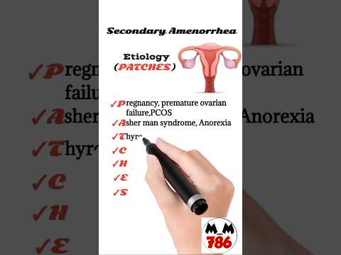 Understanding Secondary Amenorrhea: Key Causes and Symptoms