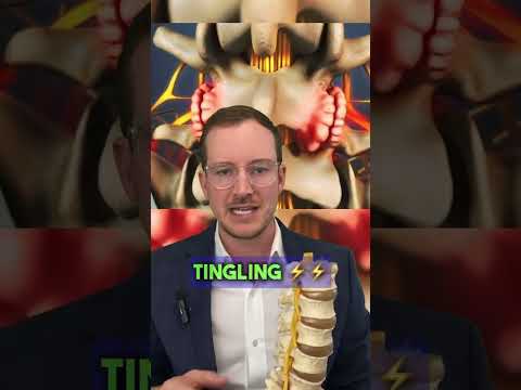 Understanding Bone Spurs: Causes, Symptoms, and Treatment