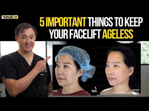 Essential Insights on Facelifts for Your Health and Wellness
