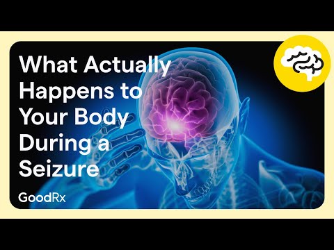 What Your Brain Goes Through During a Seizure
