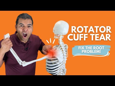 Understanding Rotator Cuff Tears: What You Should Know