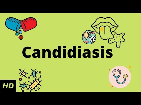 Candidiasis of the Skin: Understanding Causes and Care