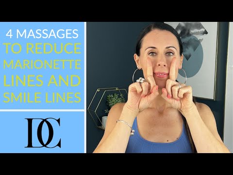 Banishing Marionette Lines: Solutions for a Youthful Look