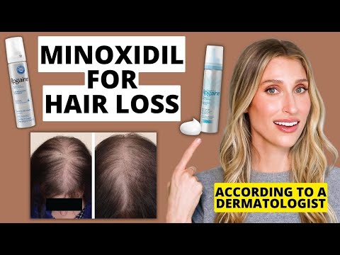 Minoxidil For Women Solution - Uses, Side Effects, and More