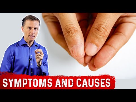 Iron-Deficiency Anemia: Recognize Symptoms and Causes