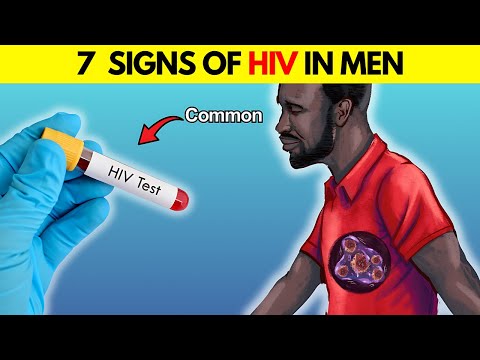 27 Key HIV Symptoms Every Man Should Recognize
