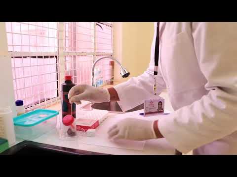Understanding the Stool Sample Culture Test Process