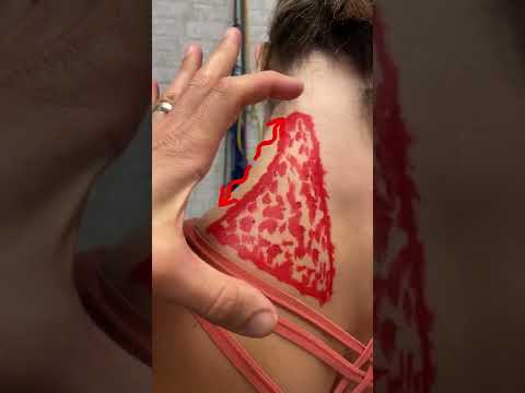 Understanding Trapezium Anatomy and Treatments for Pain Relief