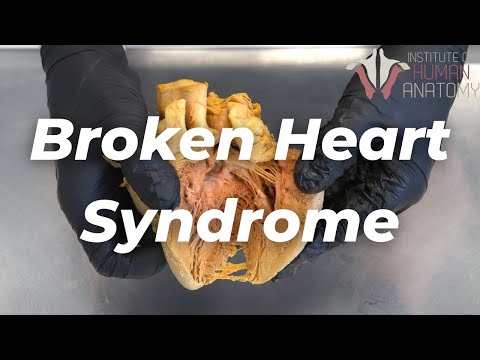 Can a Broken Heart Truly Lead to Death? post thumbnail image