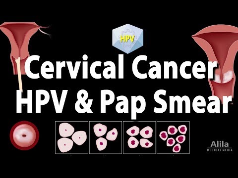 Understanding Pap Tests: Purpose, Procedure, and Results