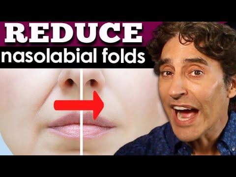 Smooth Your Smile: Nasolabial Folds and Their Solutions