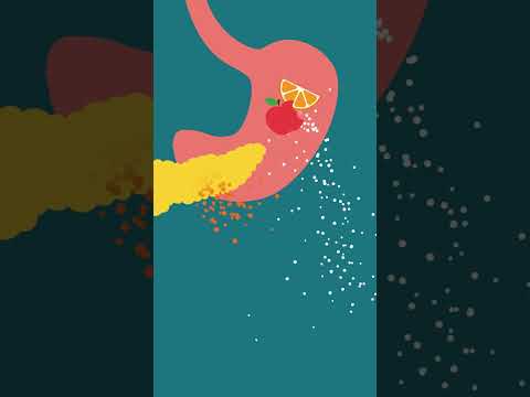 Understanding Hyperinsulinemia: Symptoms and Treatment Options